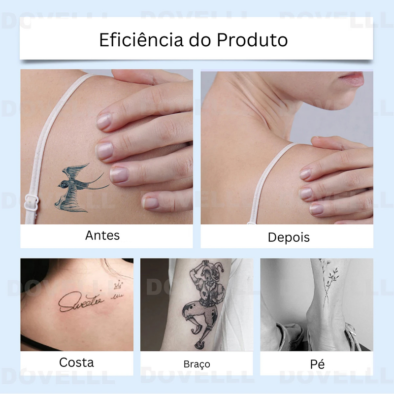 Gel de Remoção de Tatuagem - Eelhope